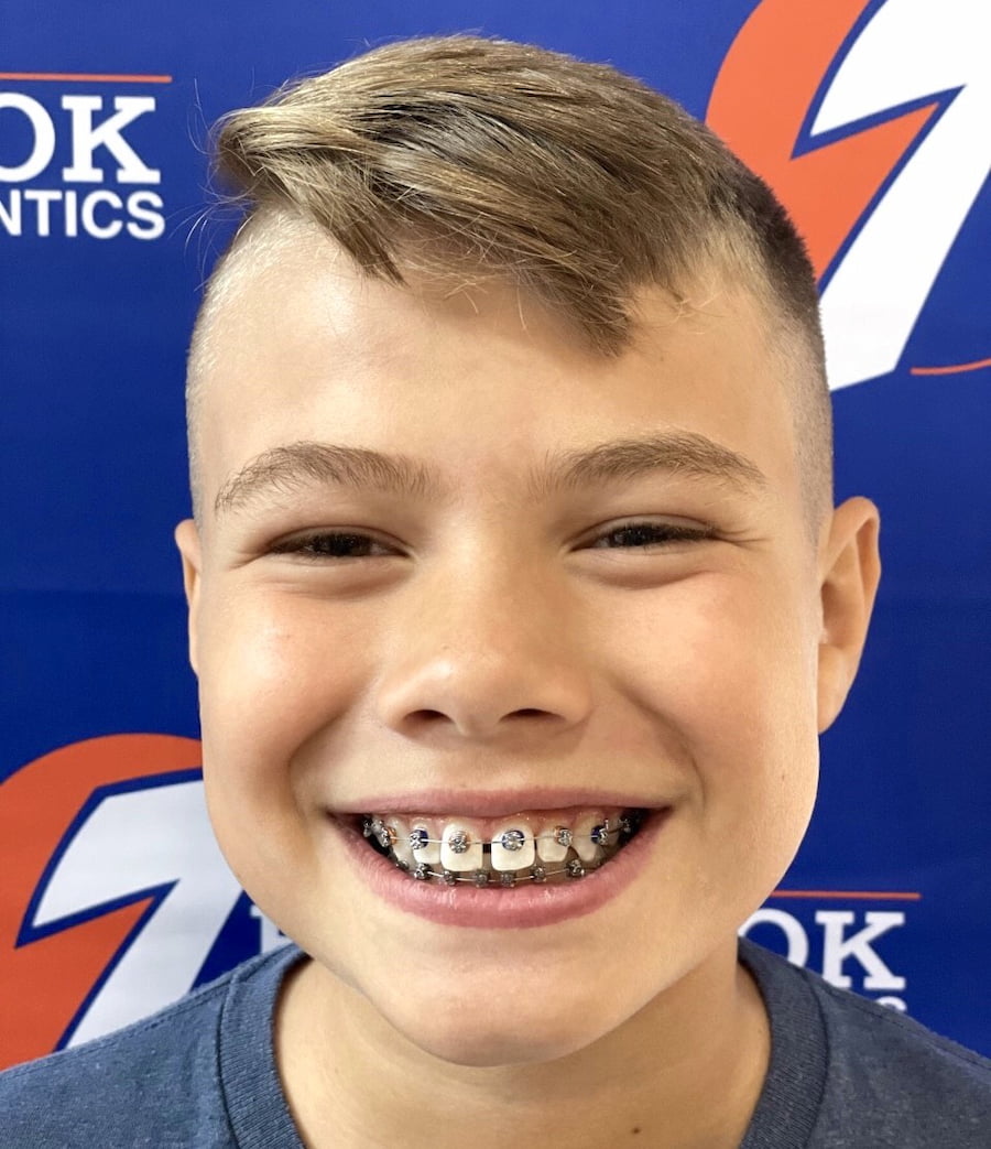 TenBrook Orthodontics Top Orthodontist in South Jersey